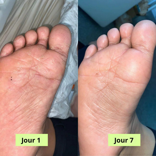 Nola Savon Purifiant Antifongique