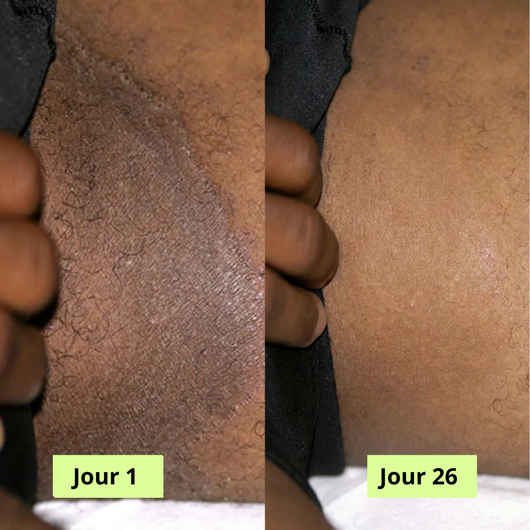 Nola Savon Purifiant Antifongique